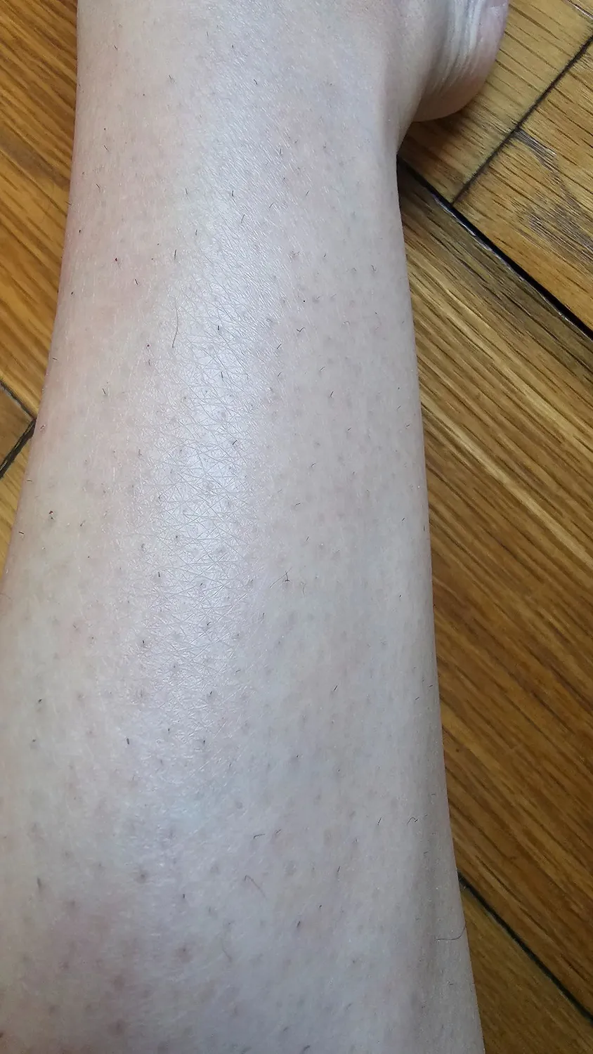 Ulike Air 10 Pro IPL-Haarentfernungsgerät Violett