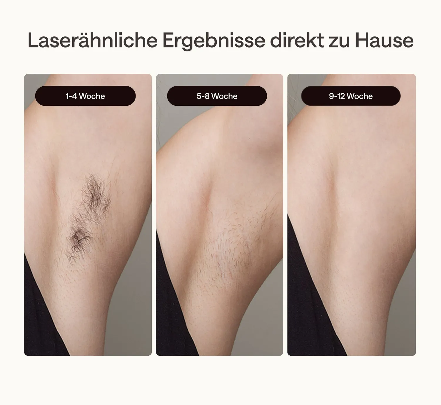 Ulike Air 2 IPL-Haarentfernungsgerät Set Dunkelgrün