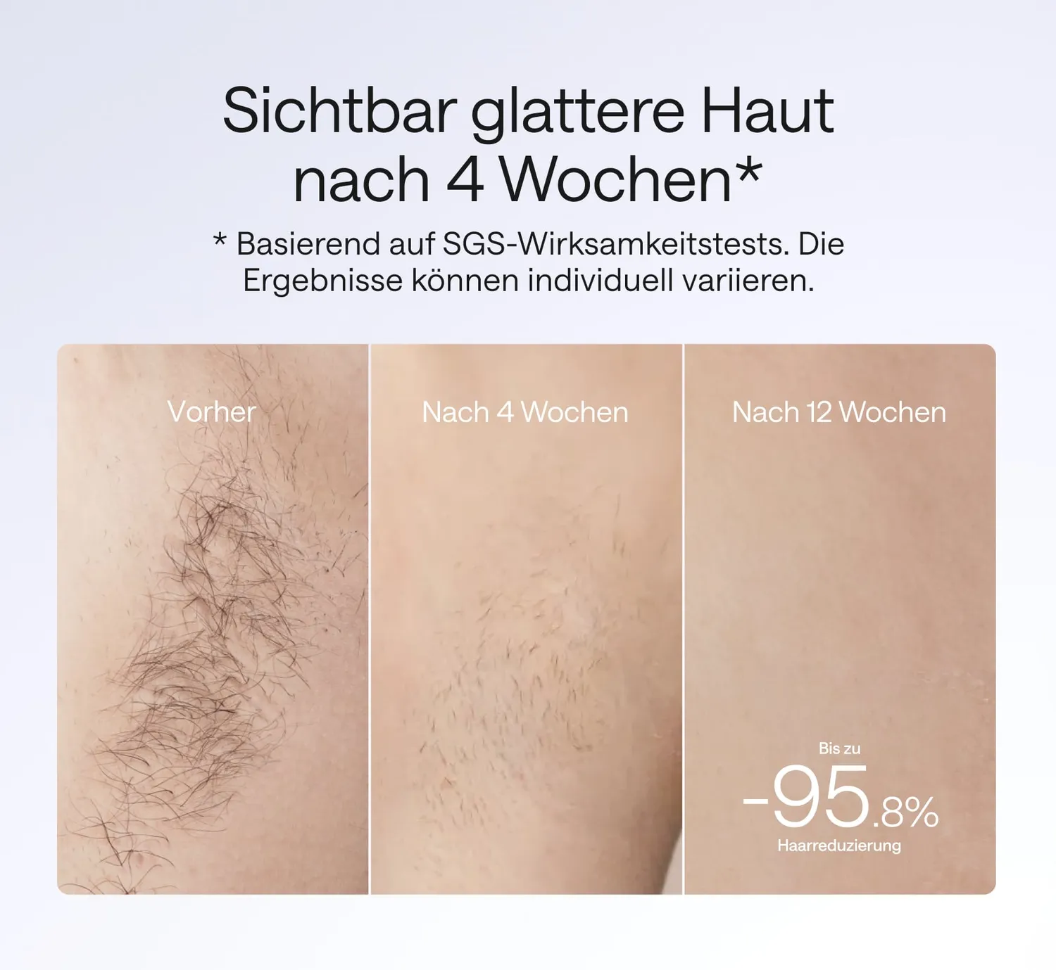 Ulike Air 4 IPL-Haarentfernungsgerät Lila Saphir